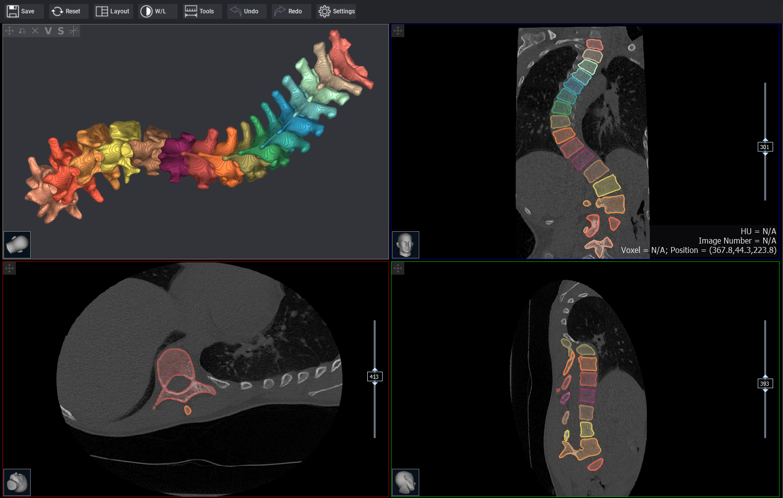 Digital Transformation